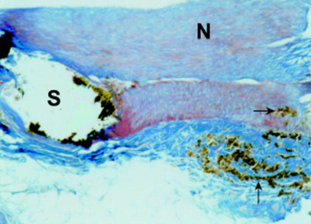 Figure 4  