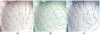 Fig. 11
