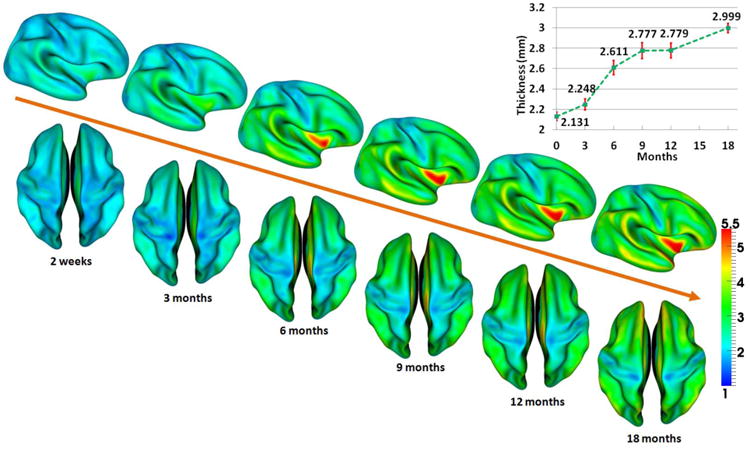 Fig. 13