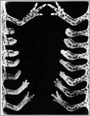 Fig. 13