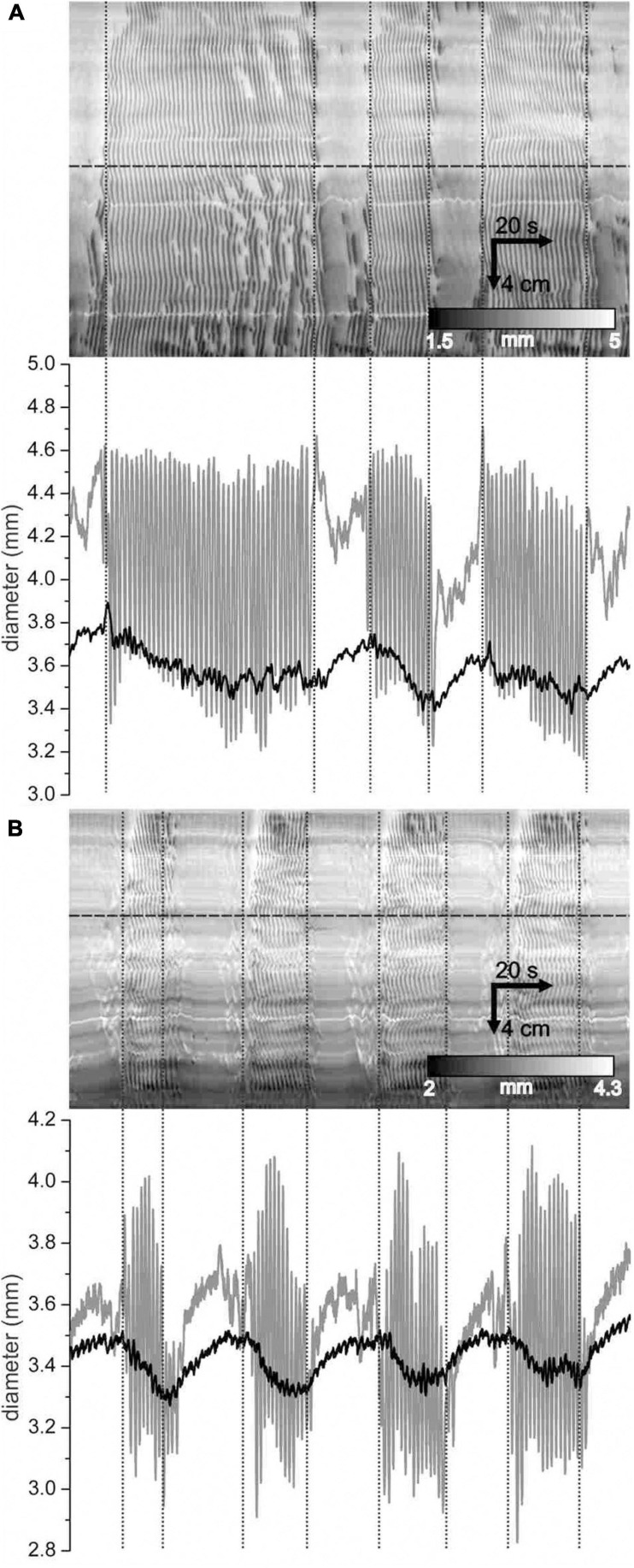 FIGURE 10