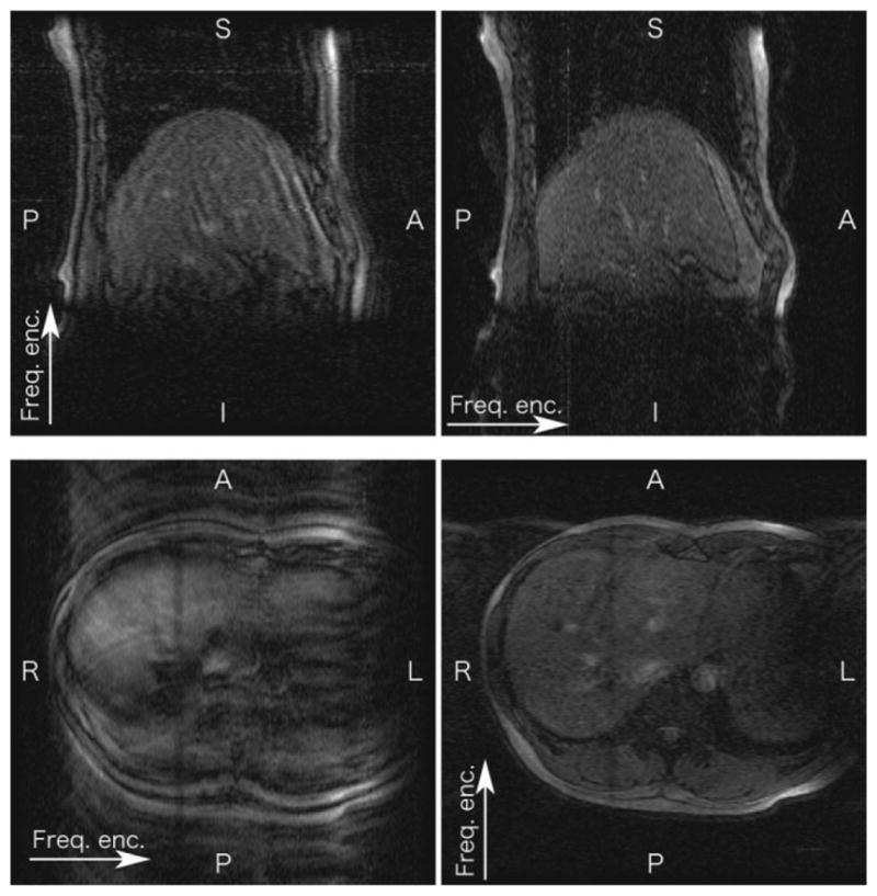 FIG. 10