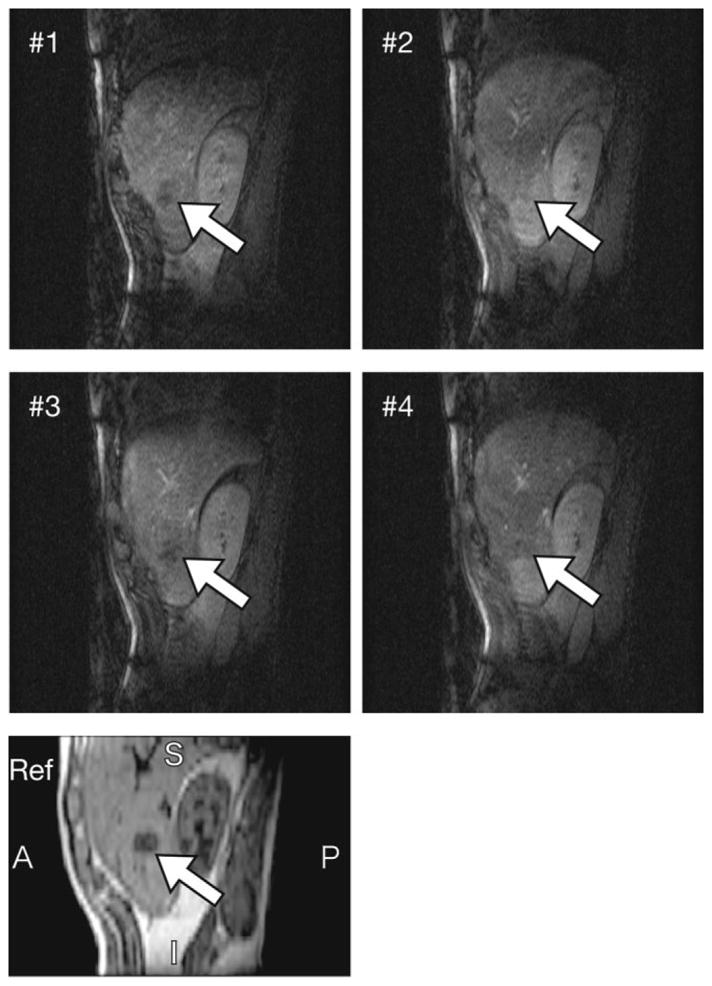 FIG. 11