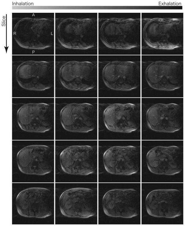 FIG. 9