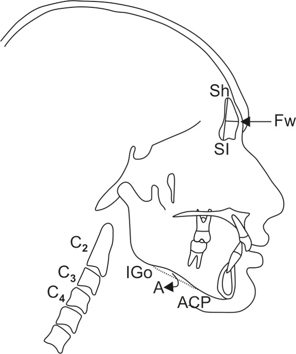 Fig. 2