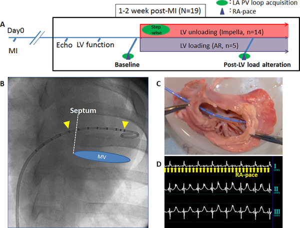 Central Illustration: LV Unloading Relieves LA Stretch and Inhibits Arrhythmias.