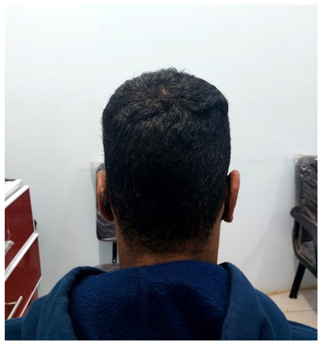 Fig. 13
