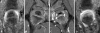 Fig. 5A–D
