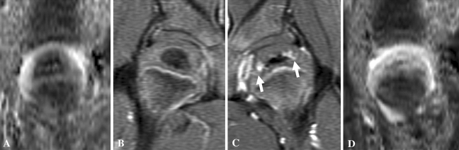 Fig. 5A–D