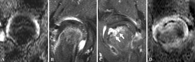 Fig. 6A–D