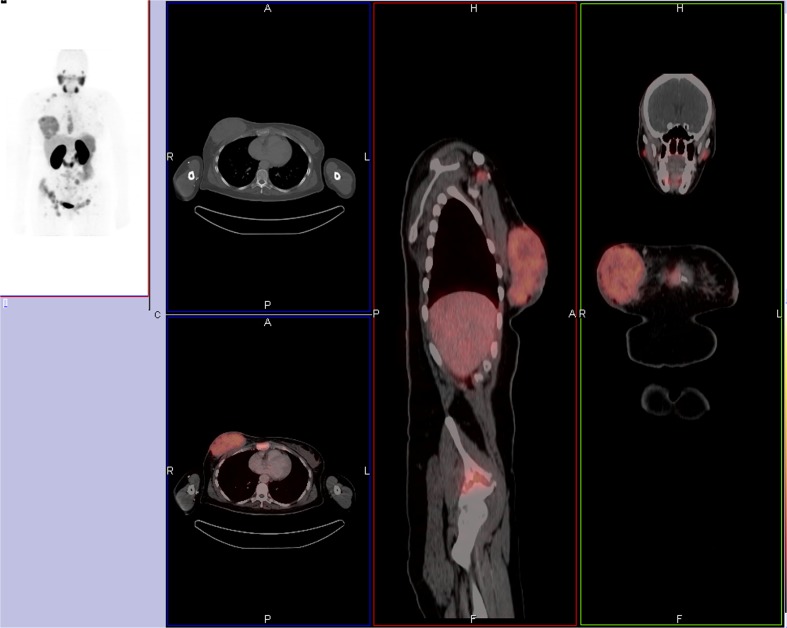 Fig. 2