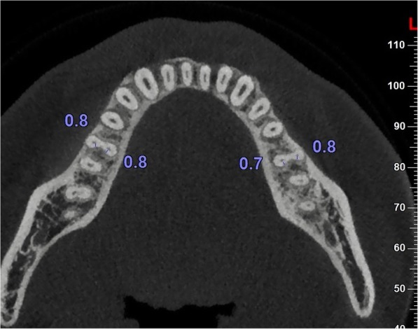 Fig. 1