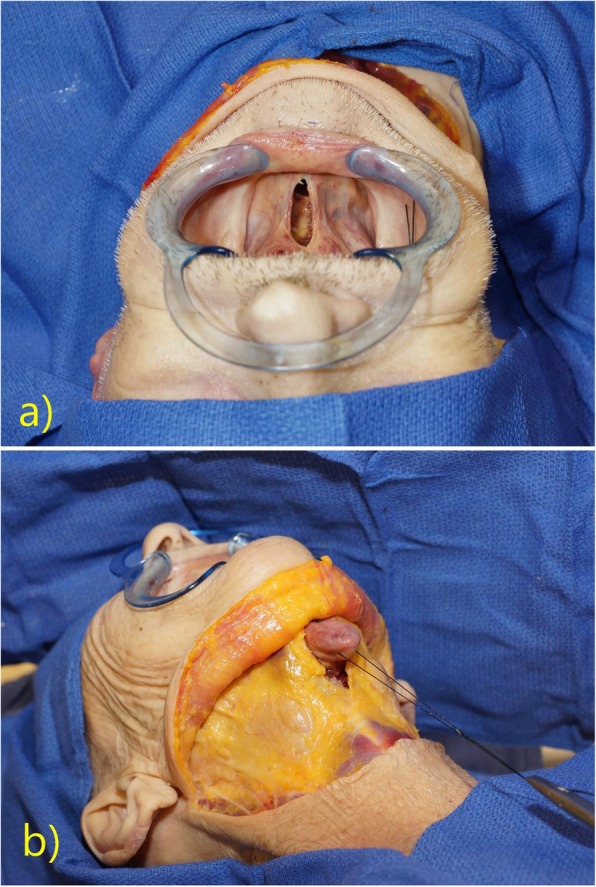 Fig. 2