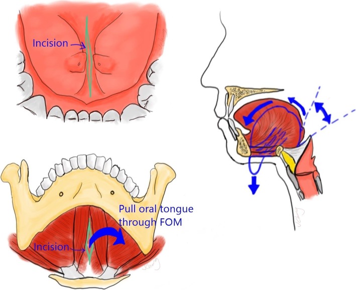 Fig. 1