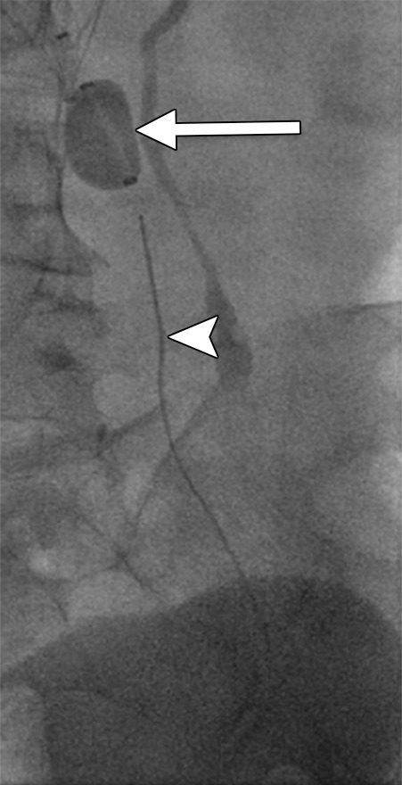 Figure 4c: