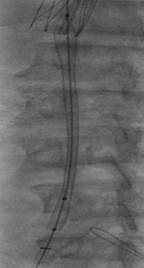 Figure 11e: