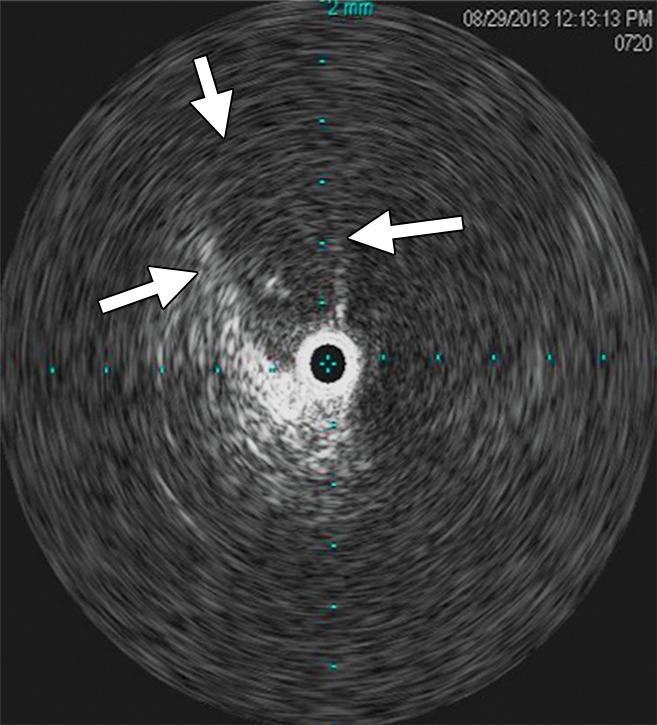 Figure 13b: