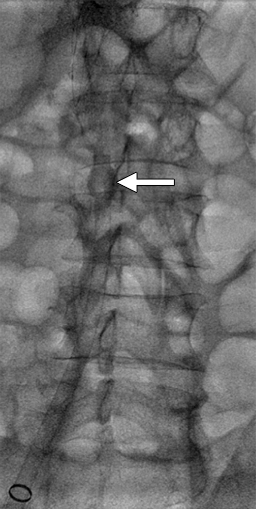 Figure 3b: