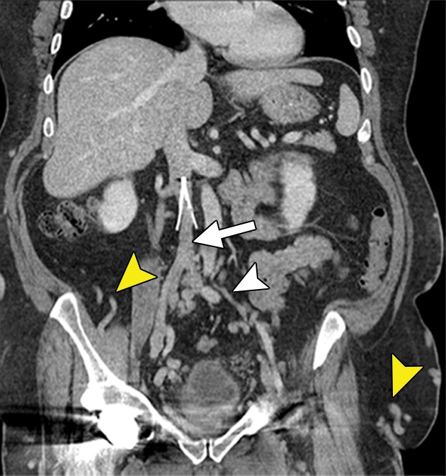 Figure 7a: