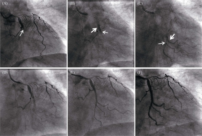 Figure 2.