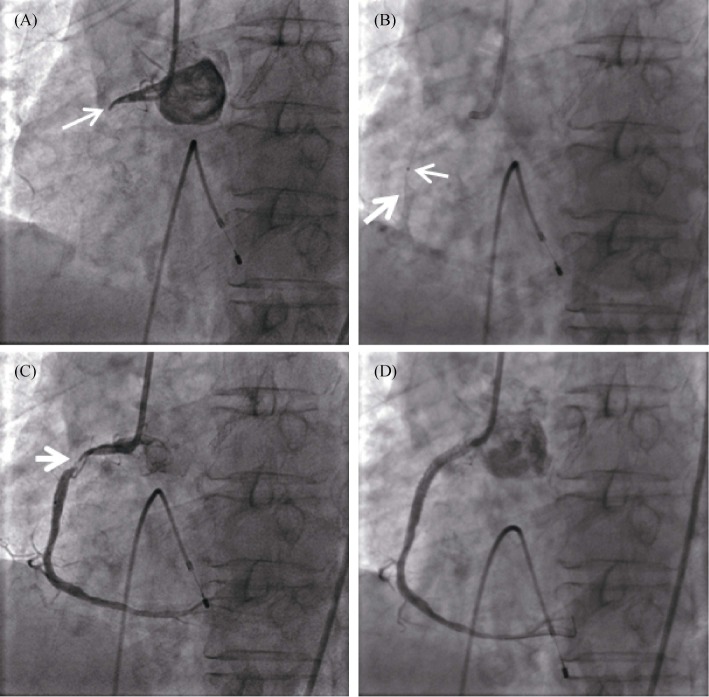 Figure 4.