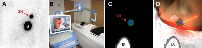 Fig. 1