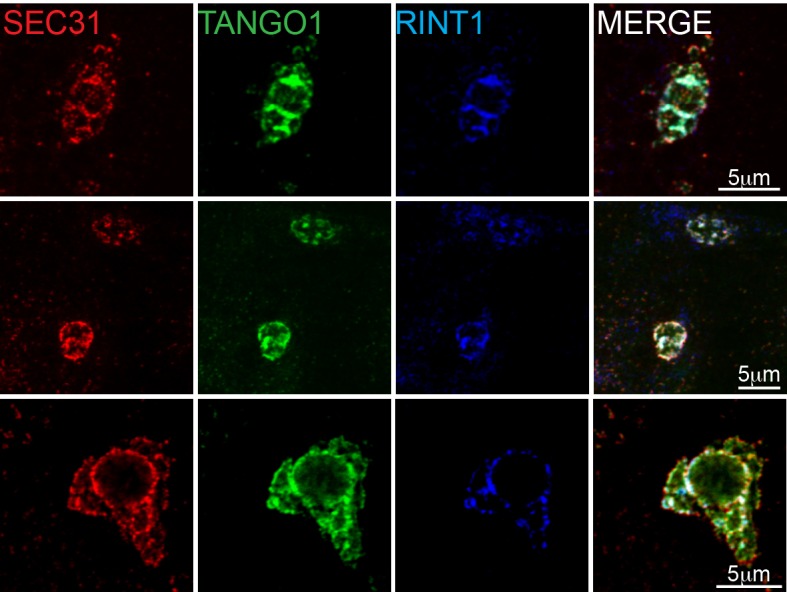 Figure 6—figure supplement 1.