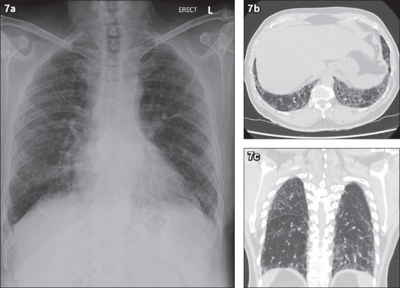 Fig. 7