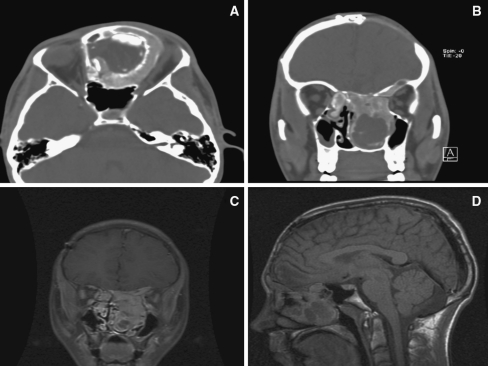 Fig. 1