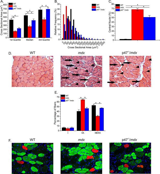 Figure 4—figure supplement 1.