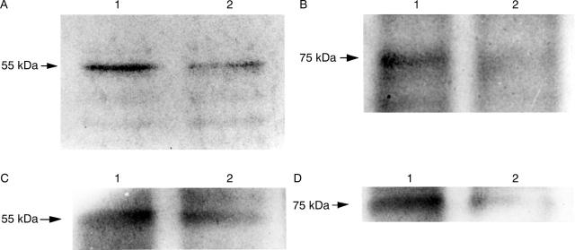 Figure 11  