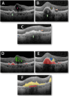 Fig. 3