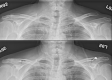 Fig 1