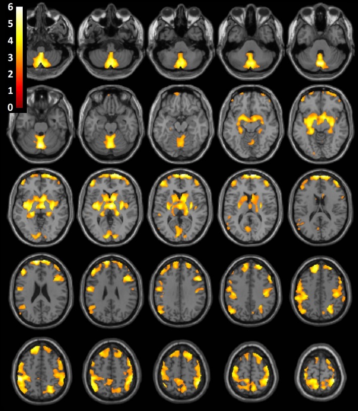 Figure 3: