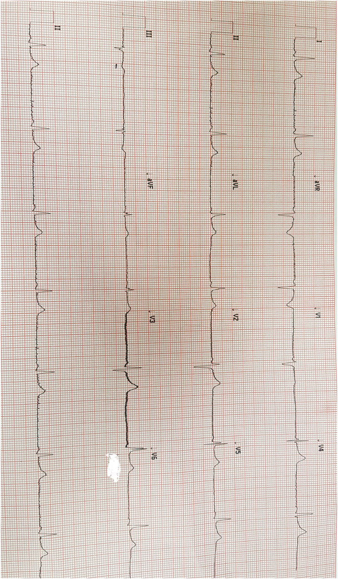 Fig. 2