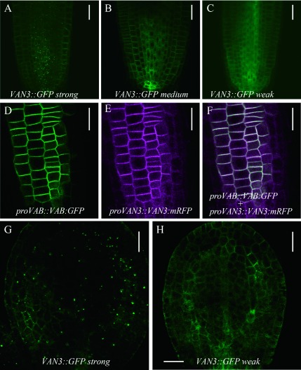 Figure 3. Subcellular localization analysis of different expression levels of VAN3. (A–C) Functional VAN3-GFP localization in root tips at different expression levels: strong expression lines (A), medium expression lines (B), and weak expression lines (C). (D–F) Colocalization analysis of VAN3-mRFP and VAB-GFP in van3vab mutants. GFP image (D), RFP image (E), and merged image (F). (G and H) Functional VAN3-GFP localization in cotyledons. Subcellular localization in strong expression lines (G) and weak expression lines (H). VAN3-GFP and VAB-GFP were excited with 488 nm laser at 15% and 20% of laser power, respectively. VAN3-mRFP was excited by 541 nm laser with 40% power. Images are taken by Olympus FV1000. Scale bars: 30 µm (A–C), 20 µm (D–H).