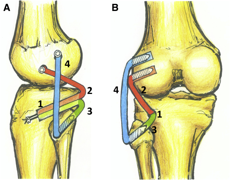 Fig 13