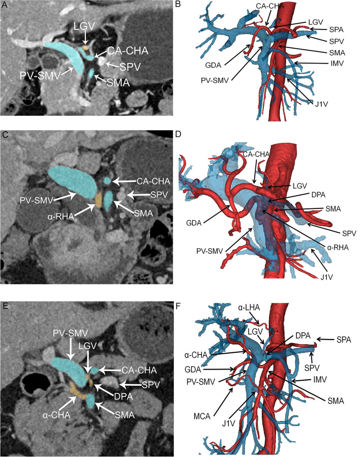 Radiological classification of the Heidelberg triangle and its ...