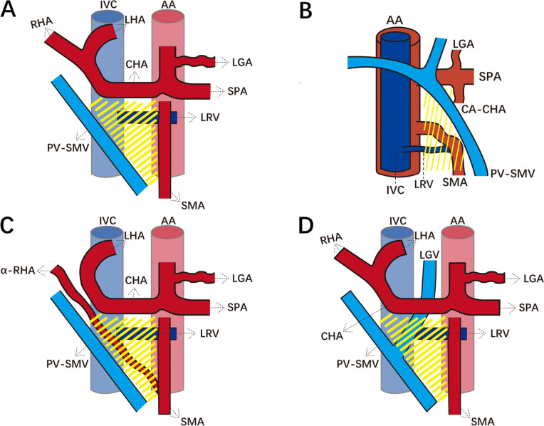 Radiological classification of the Heidelberg triangle and its ...