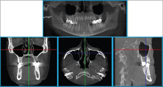 Figure 6