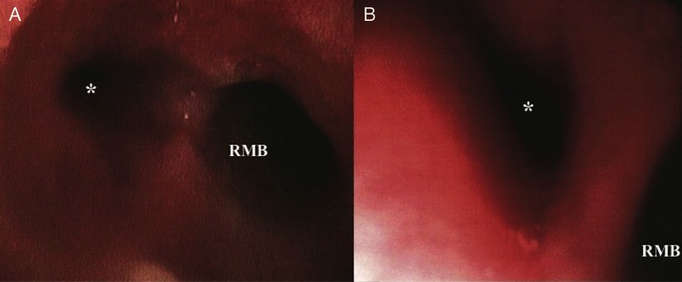 Figure 2: