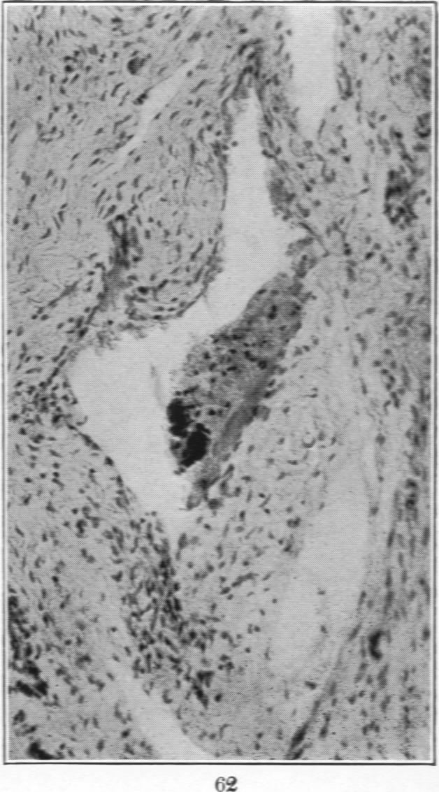 Fig. 62