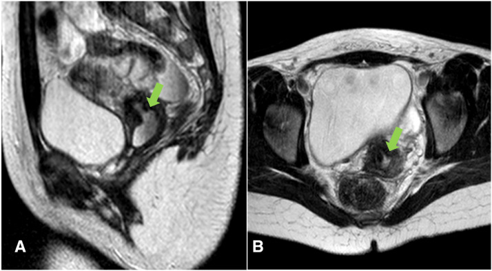 Fig 5