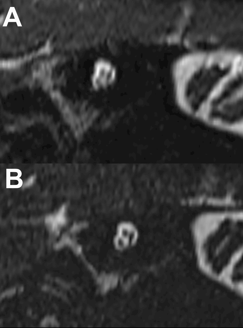 Figure 3–