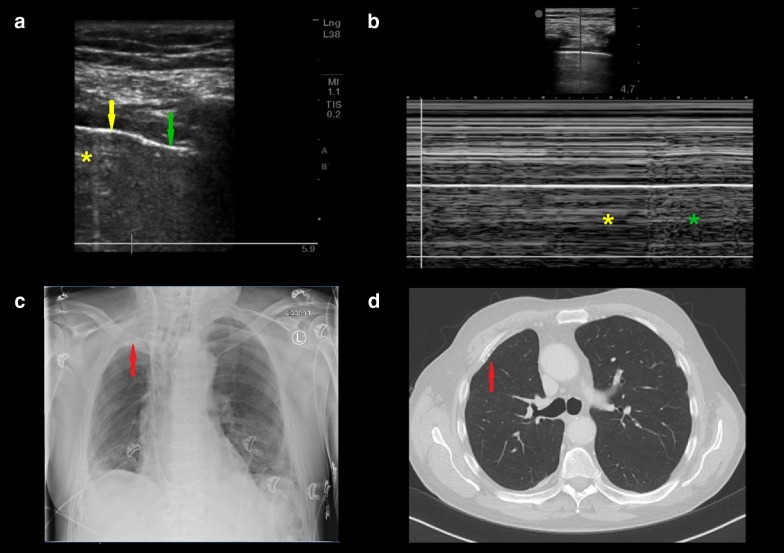 Fig. 1