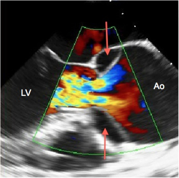 Fig. 2