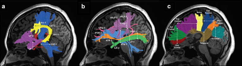 Fig. 1