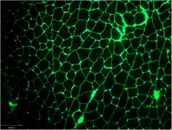 Fig. 1 (abstract A18).