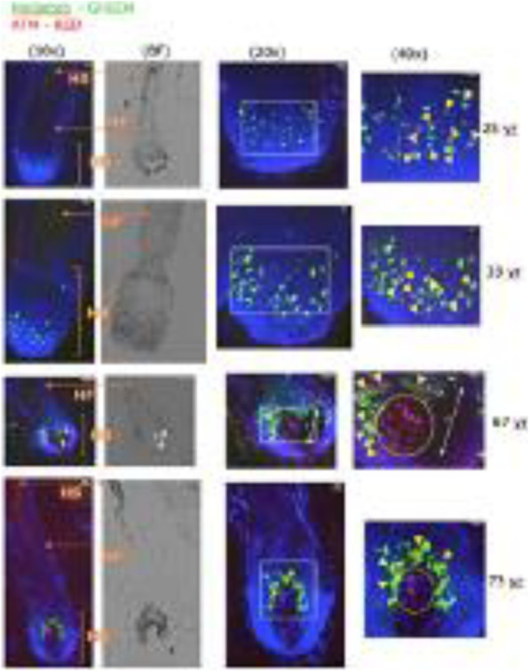 Fig. 2 (abstract A16).