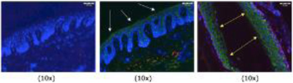 Fig. 3 (abstract A16).
